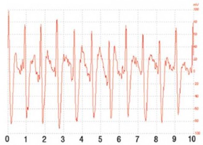 壓電薄膜傳感器在新型電子聽診器和生命體征方面的應(yīng)用
