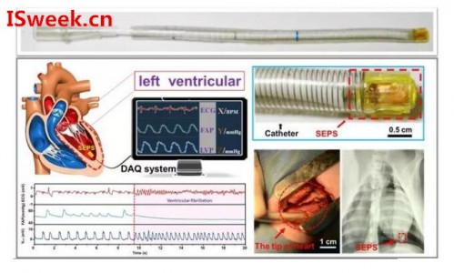 光纖壓力傳感器FOP-M260在心內(nèi)壓評估的應(yīng)用