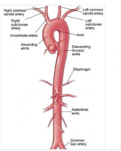 胸主動脈瘤手術(shù)過程中的壓力監(jiān)控