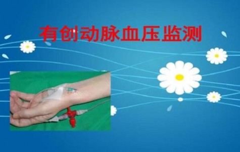 光纖壓力傳感器在有創(chuàng)動脈壓力檢測中的應(yīng)用